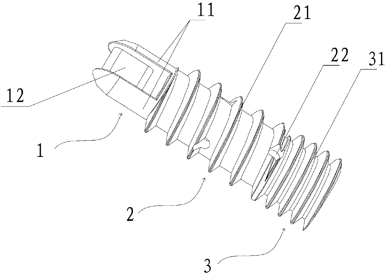 Ligament fastening screw