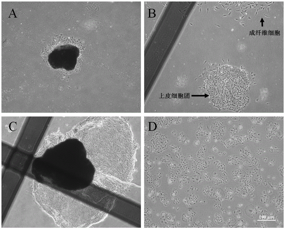 Primary isolated culture method for dairy cow mammary epithelial cells