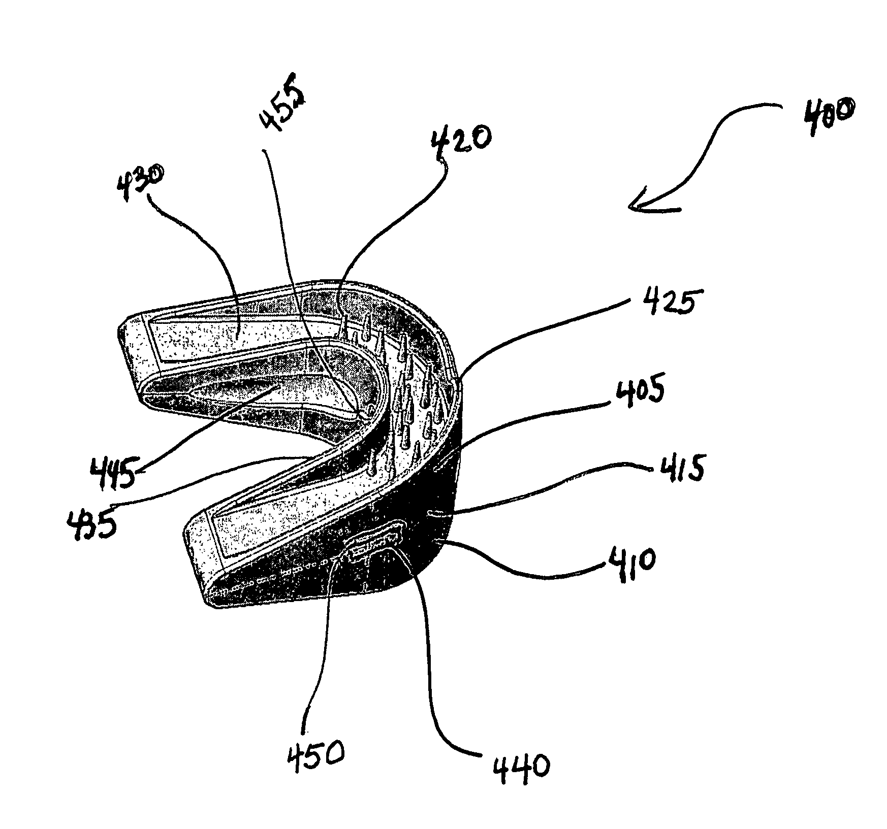 Mouthguard