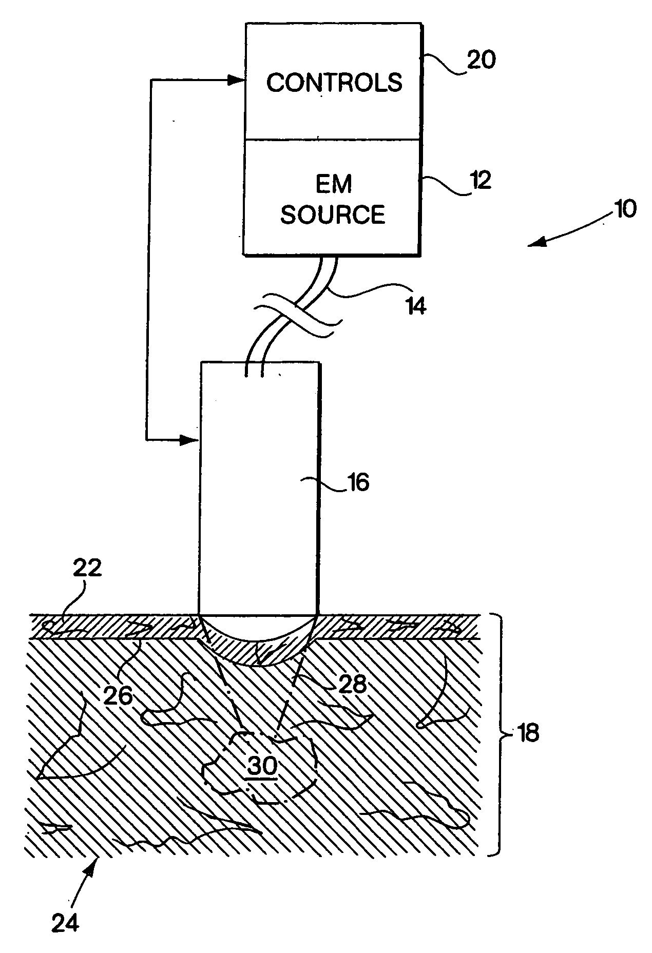 System for electromagnetic radiation dermatology and head for use therewith