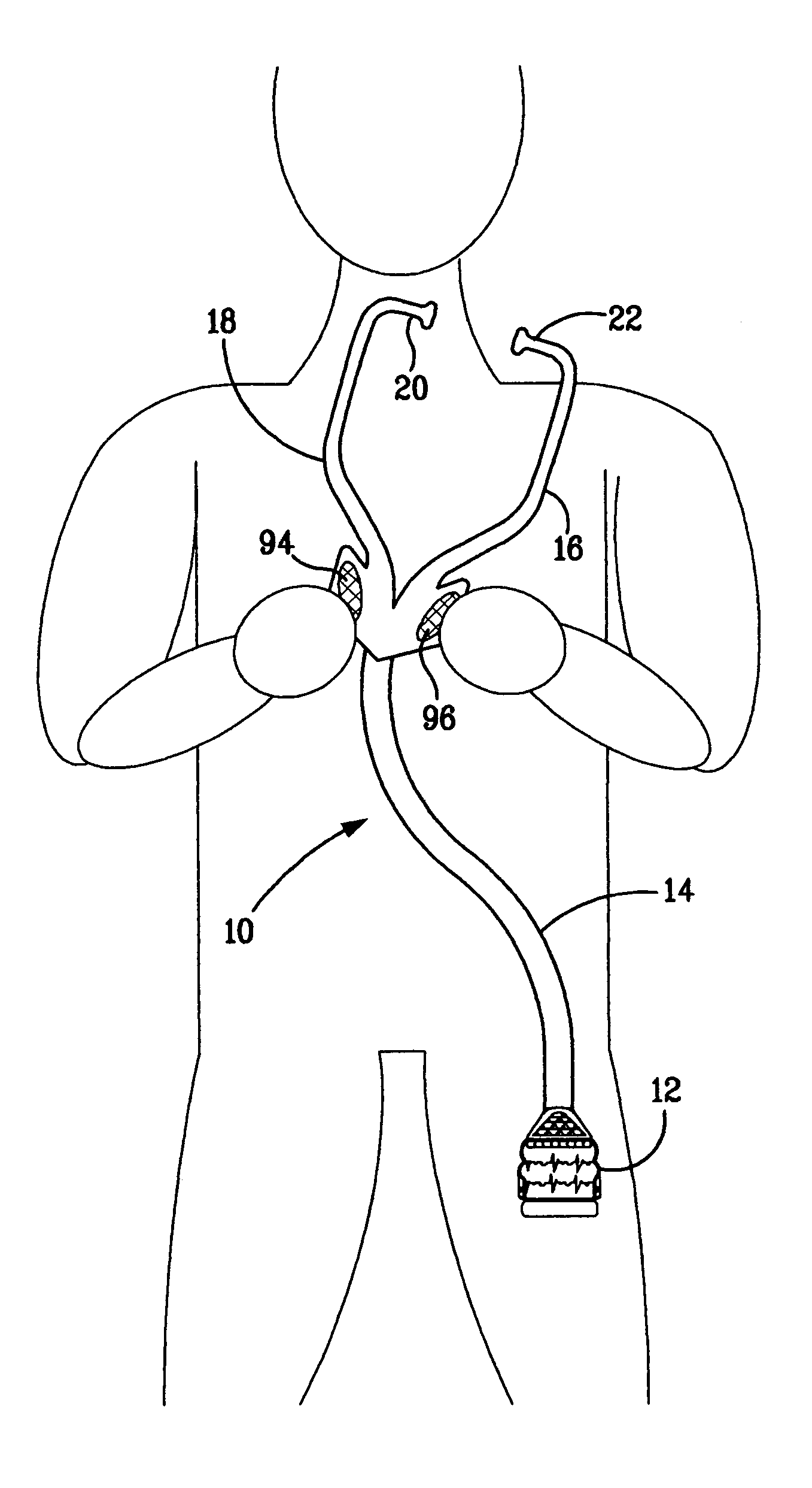 Medical examination apparatus