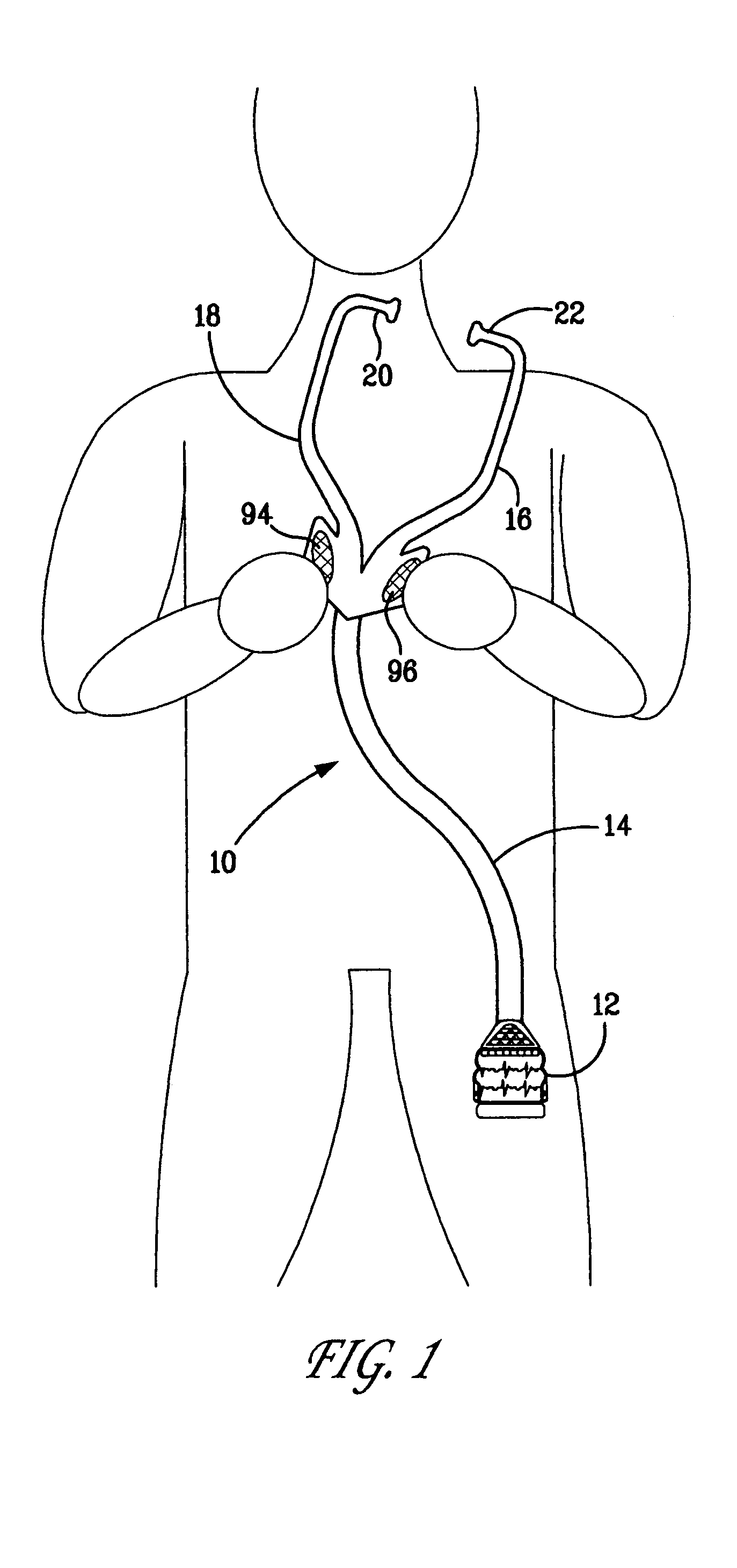 Medical examination apparatus