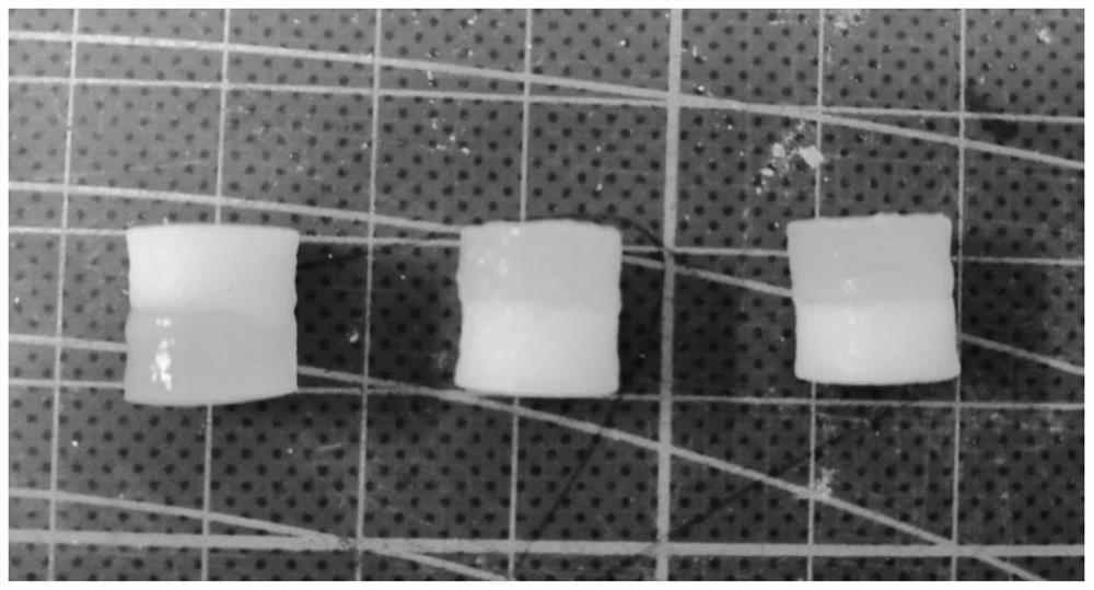 Injectable double-layer drug-loaded osteochondral repair hydrogel scaffold and preparation method thereof