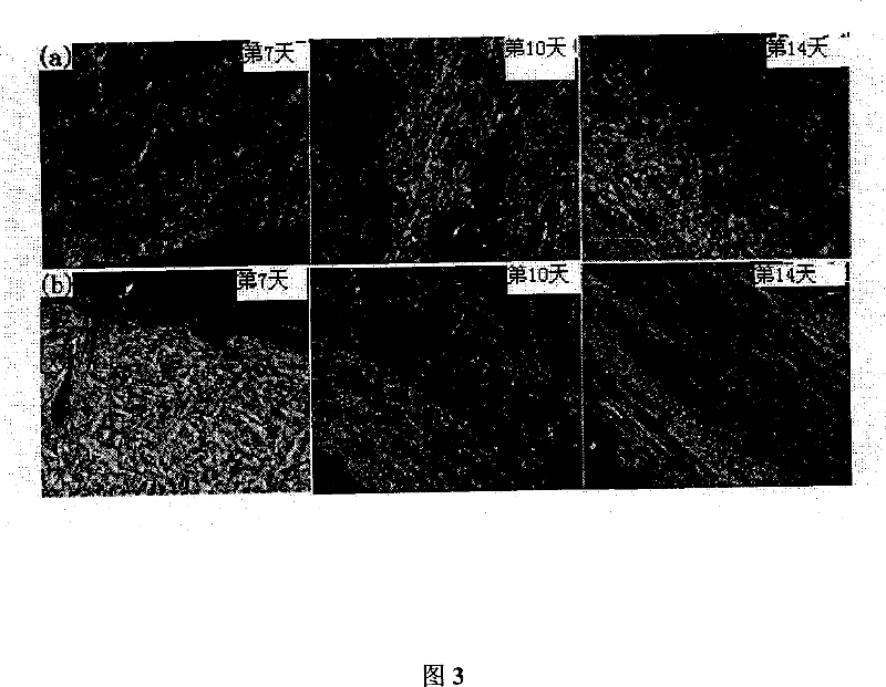 Application of self-assembled short peptide in the medicine for treating burn and face wound