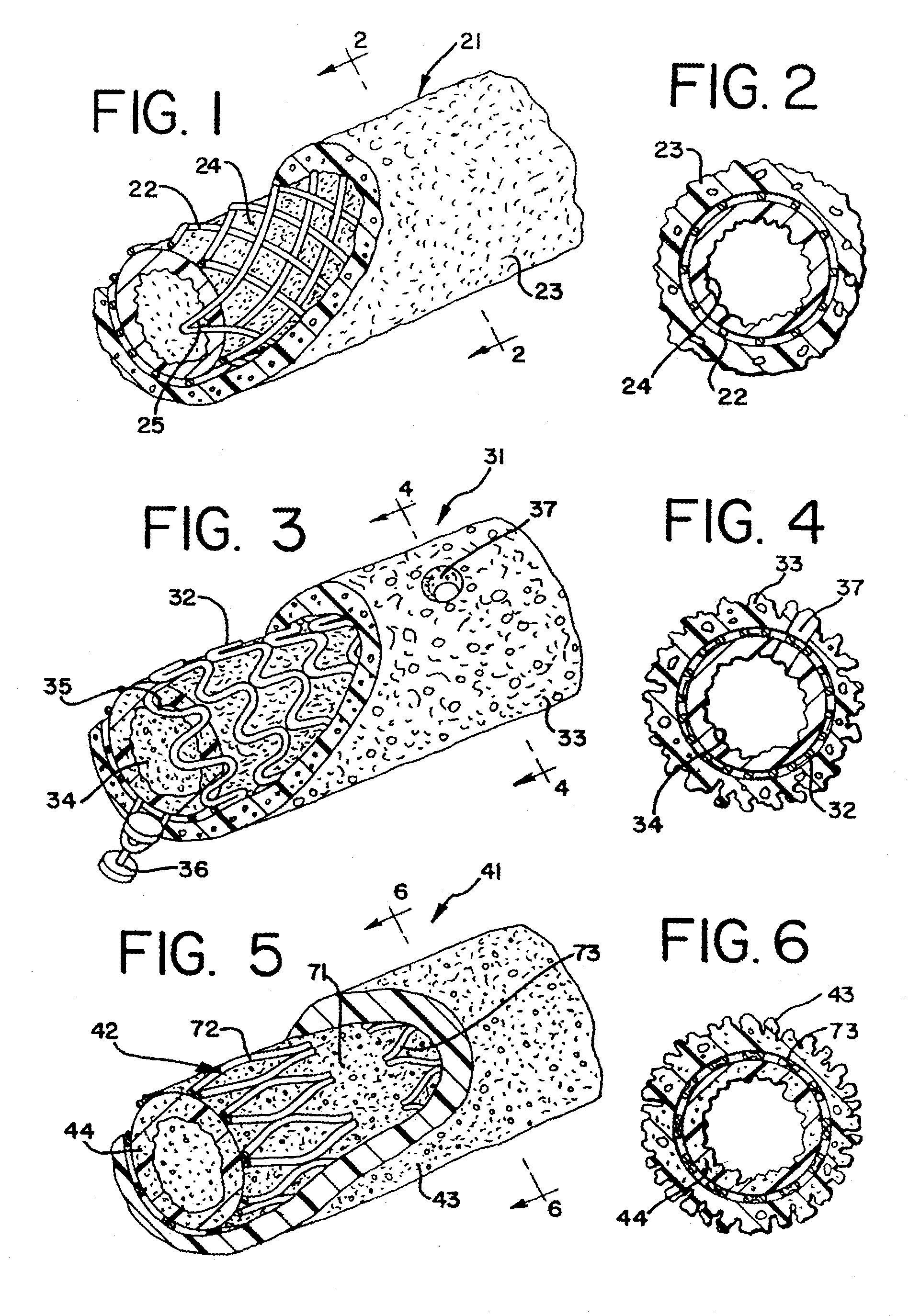 Expandable supportive branched endoluminal grafts