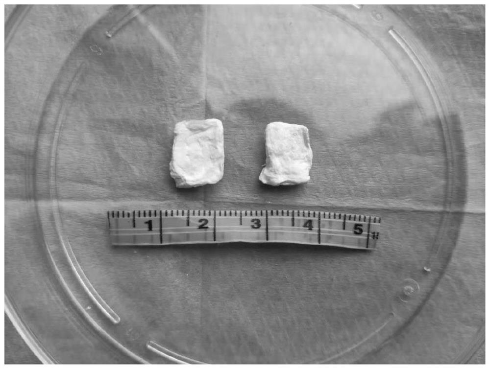 Method for preparing cartilage tissue engineering scaffold from human umbilical cord Wharton jelly and cartilage tissue engineering scaffold