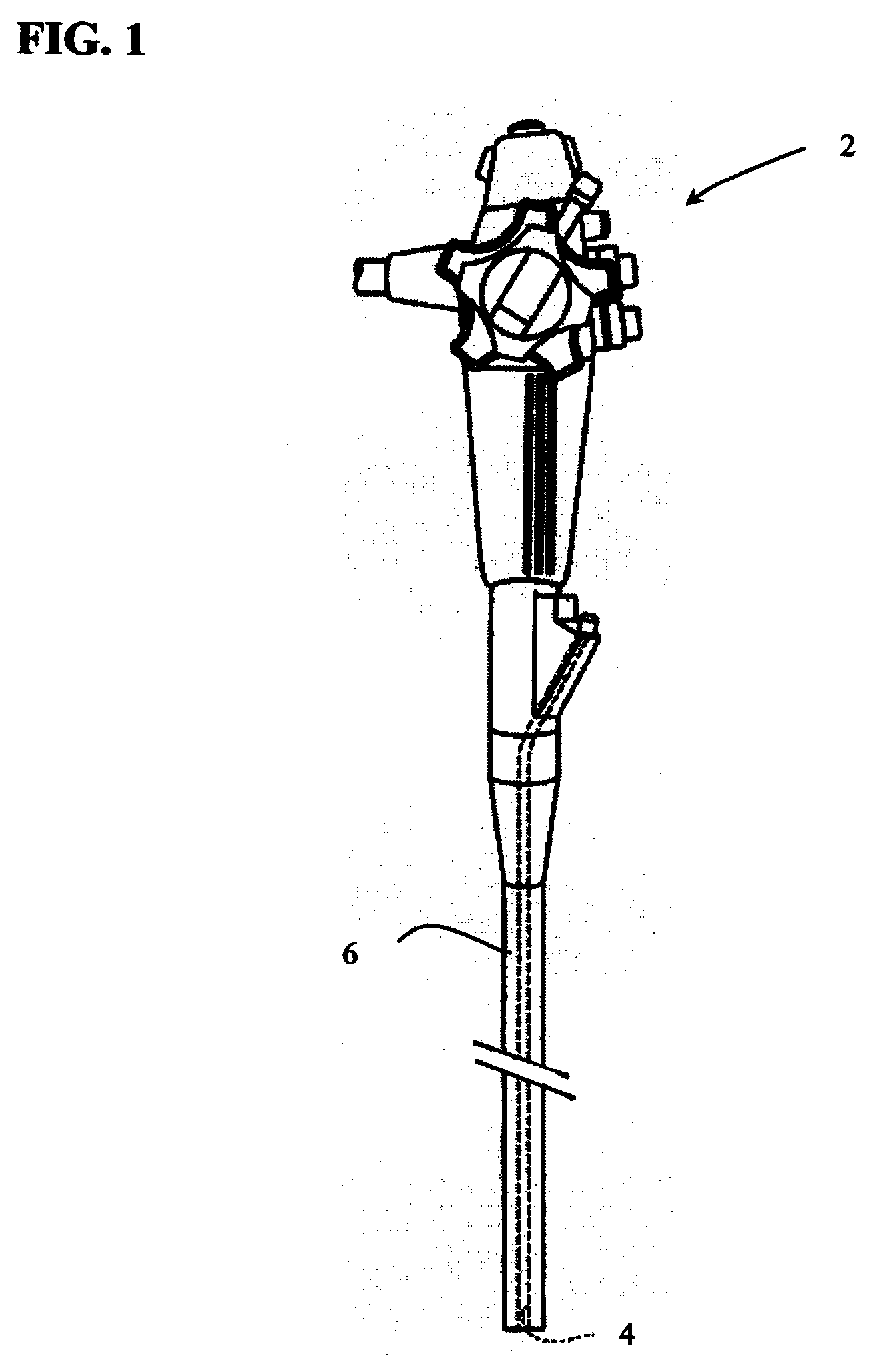 Methods And Systems for Submucosal Implantation of a Device For Diagnosis and Treatment with a Therapeutic Agent