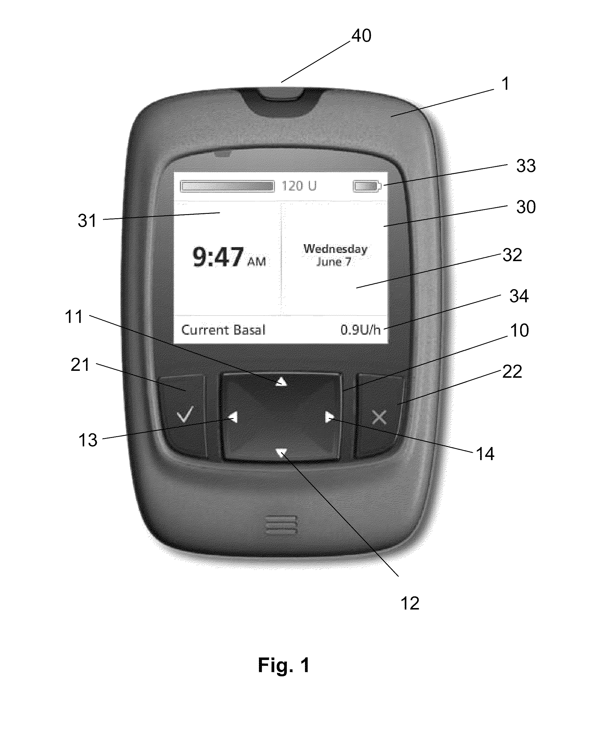 User interface for medical system comprising diary function with time change feature