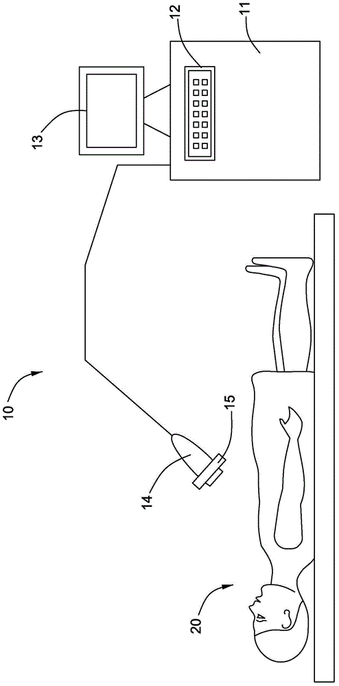 Ultrasonic apparatus and vibration device applied to ultrasonic apparatus