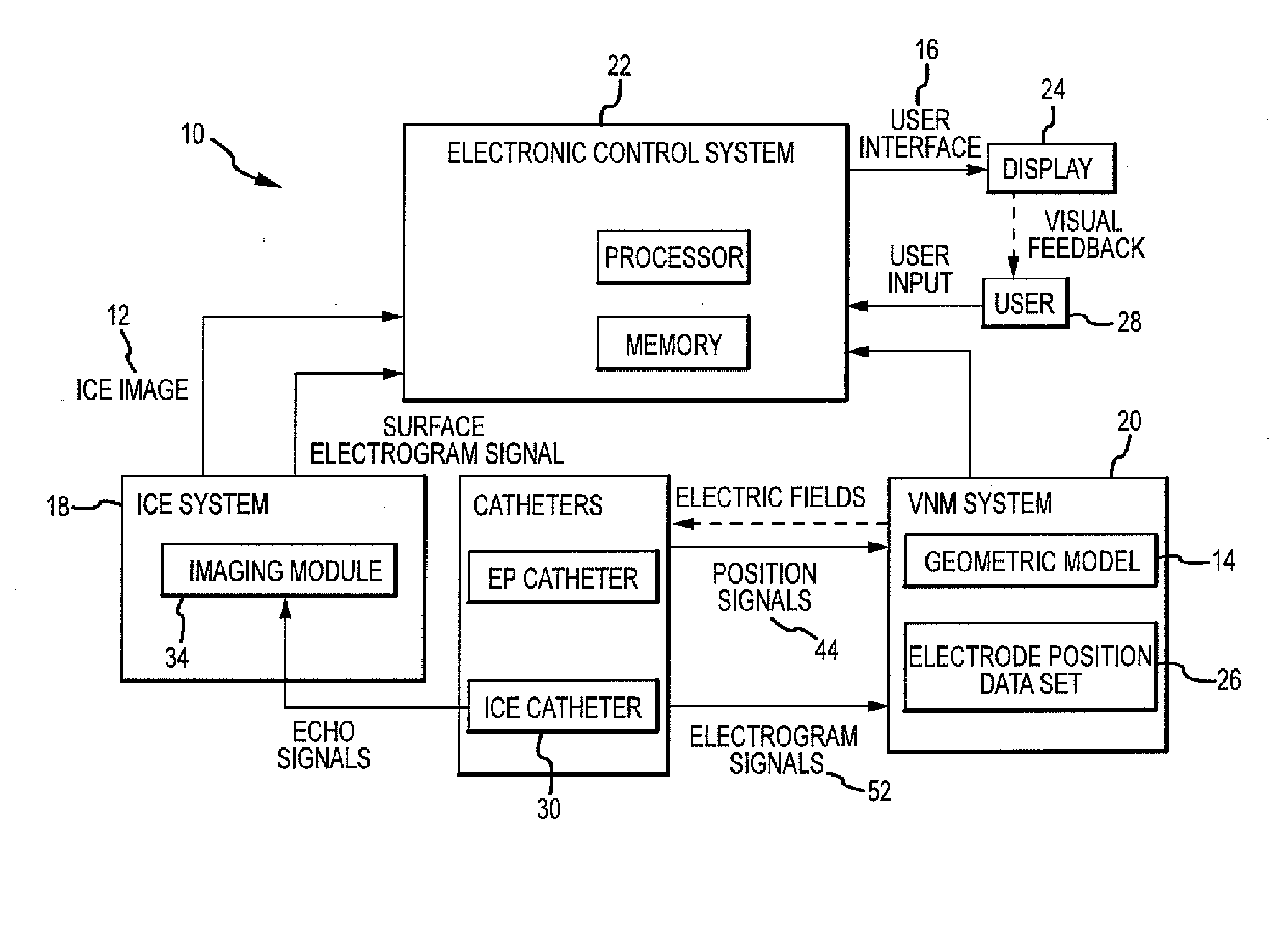 Intracardiac imaging system utilizing a multipurpose catheter