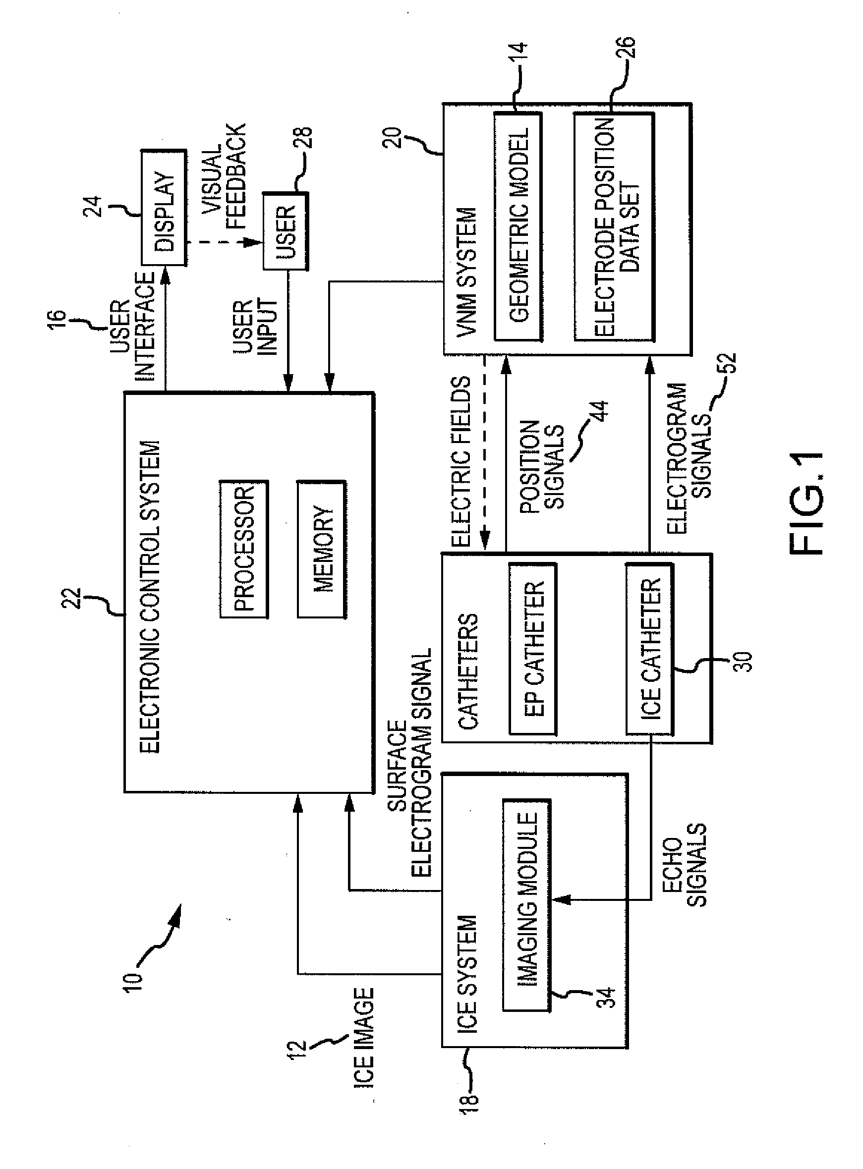 Intracardiac imaging system utilizing a multipurpose catheter