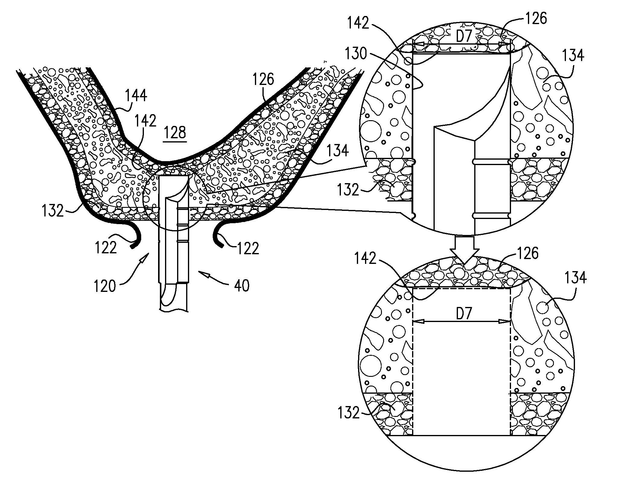 Cortical drilling