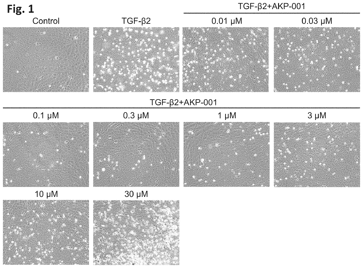 Drug for treating or preventing disorder caused by tgf-ß signalling, and application thereof