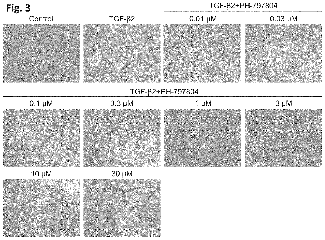 Drug for treating or preventing disorder caused by tgf-ß signalling, and application thereof