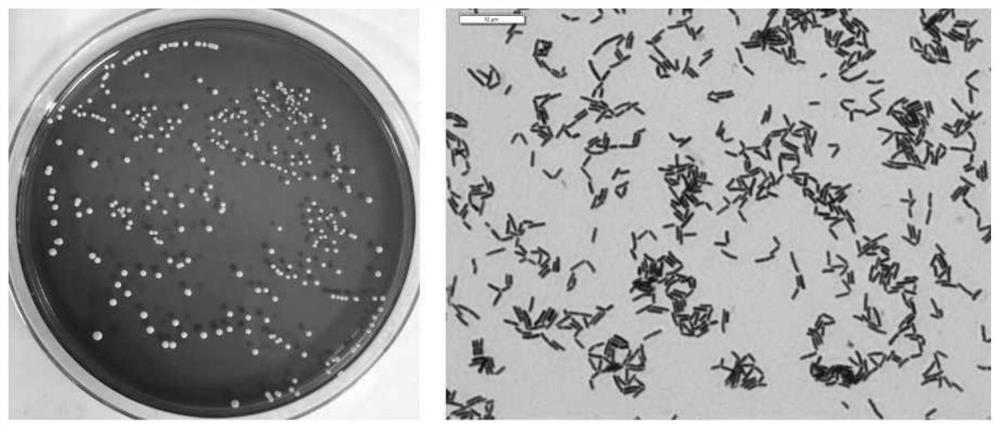 Composition based on lactobacillus plantarum and preparation method of composition