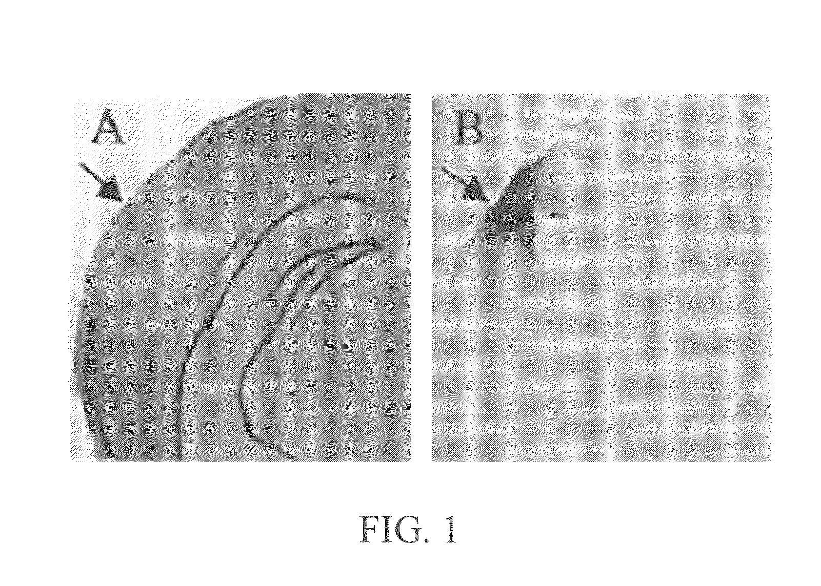 Therapeutic method of treating brain trauma in rodents with VCP