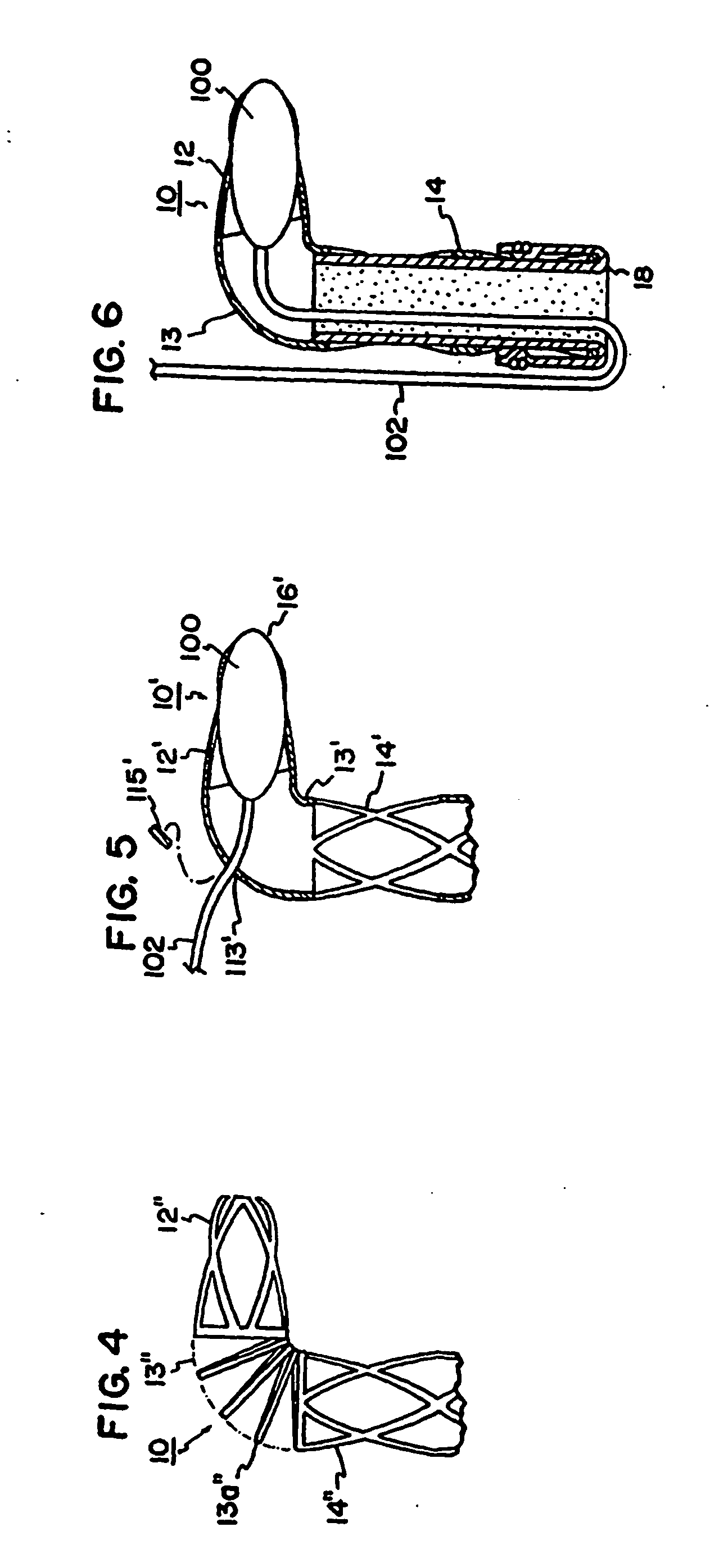 Healing transmyocardial implant