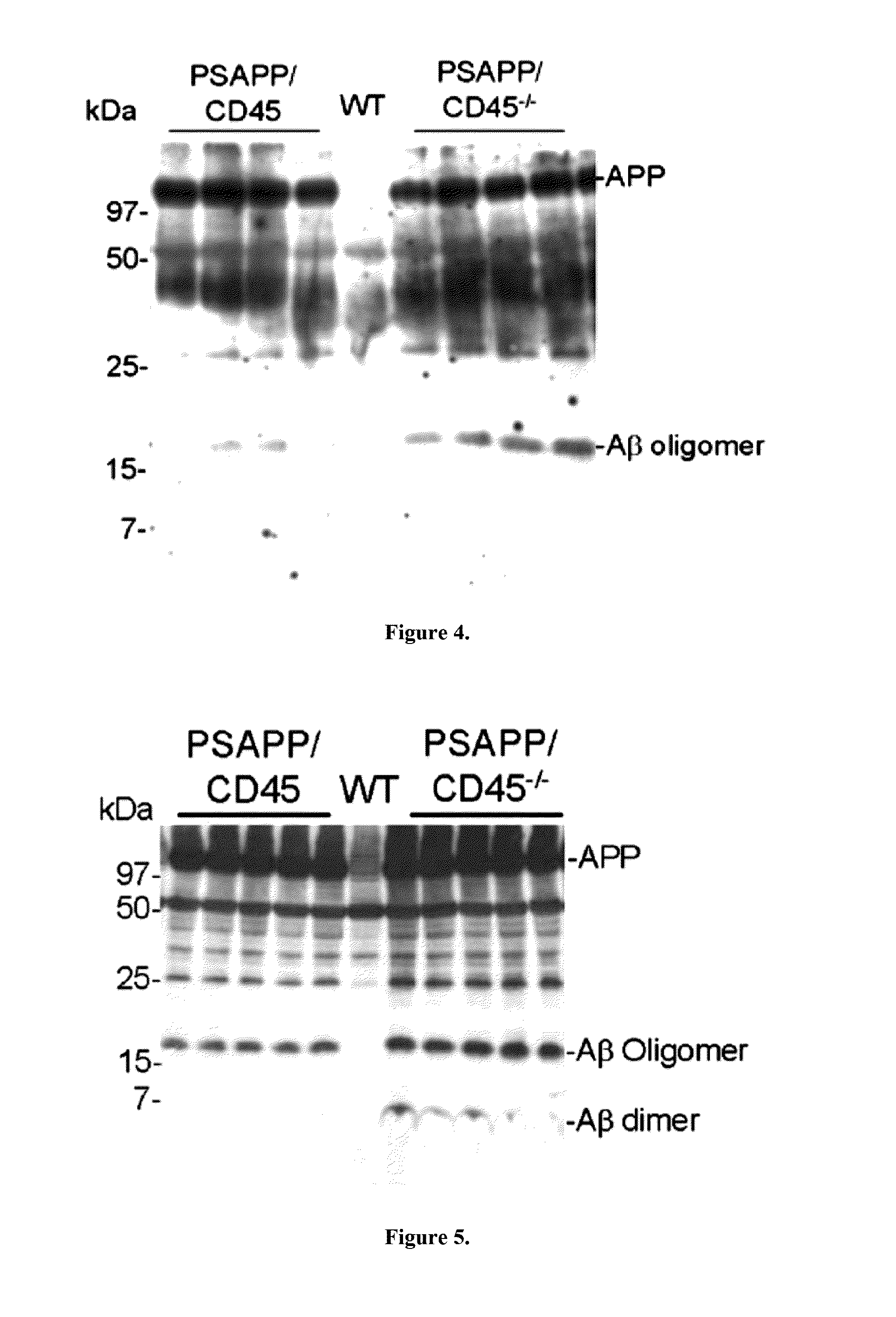 Transgenic model of alzheimer's disease