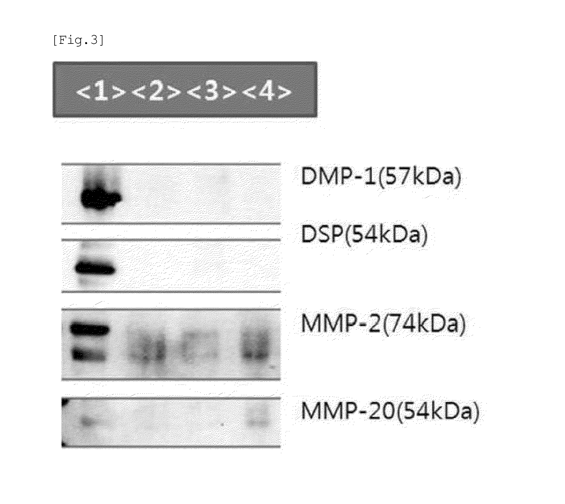 Method for Producing a Bone Transplant Material, and Bone Transplant Material Produced by Same