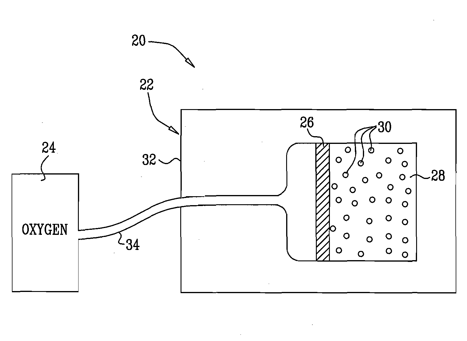 Oxygen Supply for Cell Transplant and Vascularization