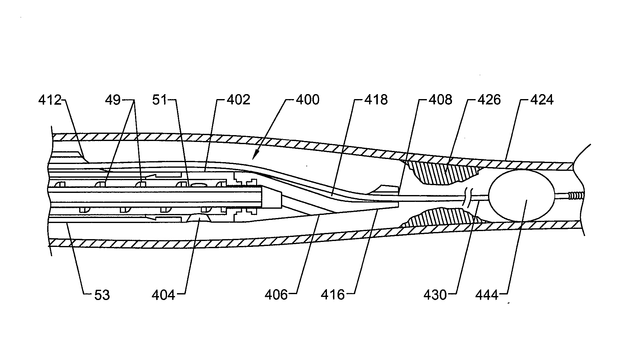 Thrombectomy and soft debris removal device