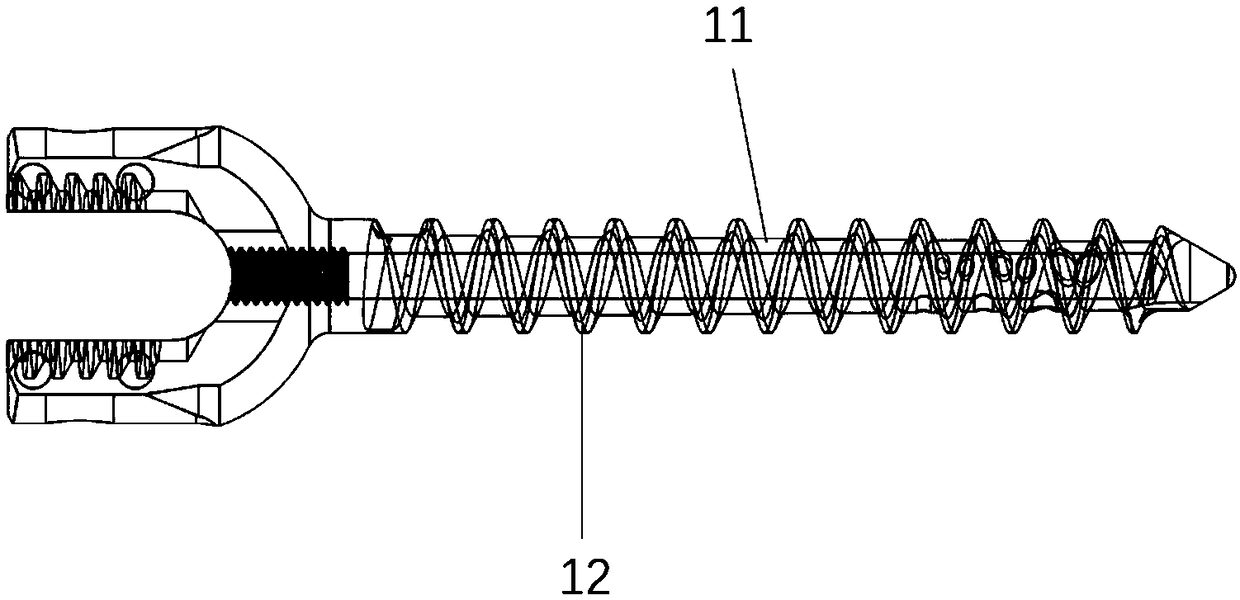 Oval side-hole type hollow pedicle screw