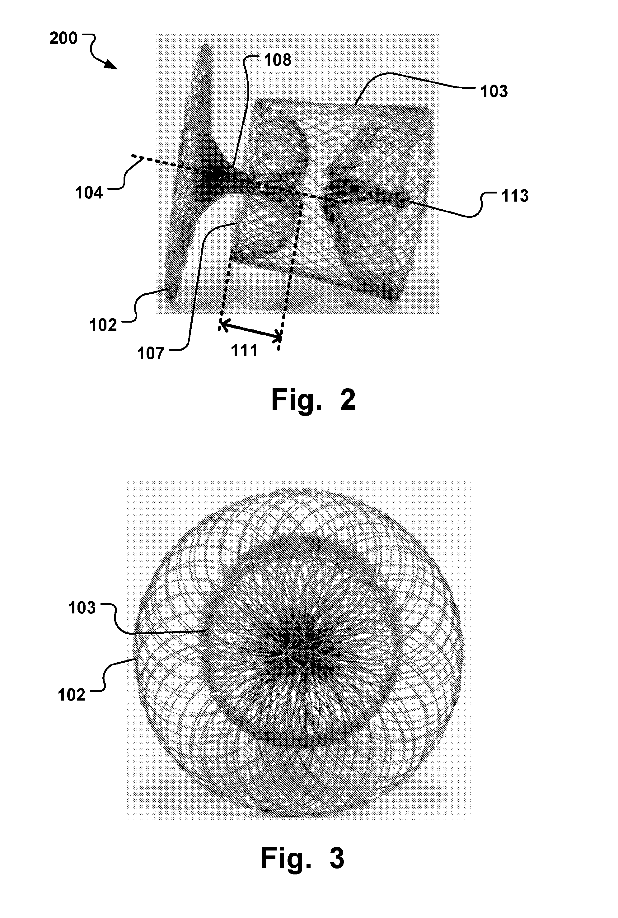 Medical Implant And Manufacturing Method Thereof