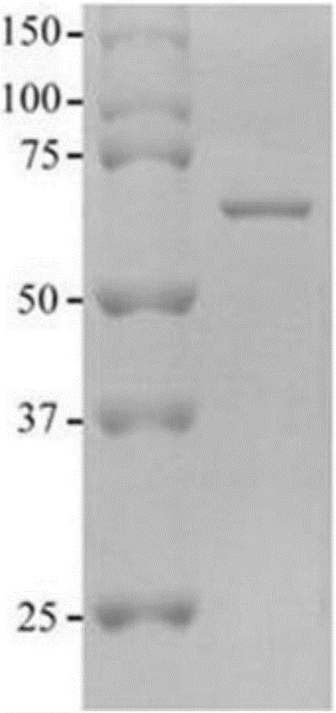 Tumorous specific antigen TSP70 and application thereof