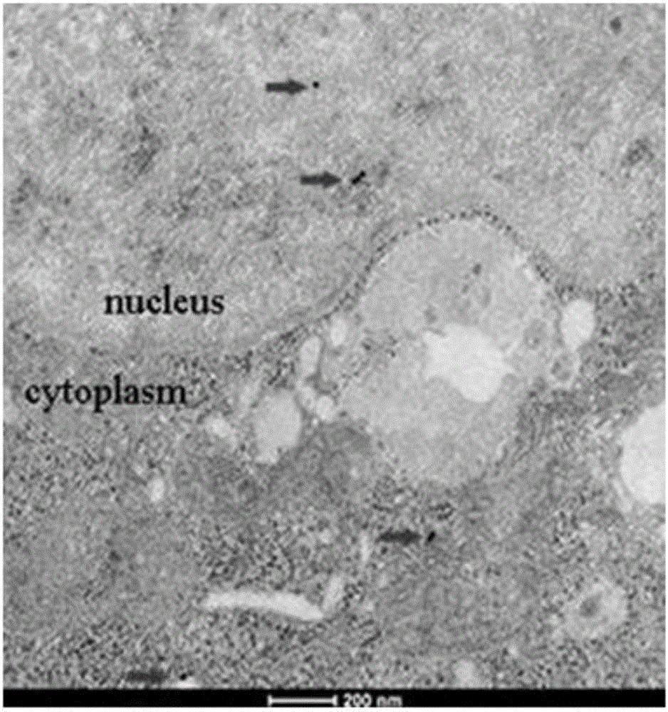 Tumorous specific antigen TSP70 and application thereof