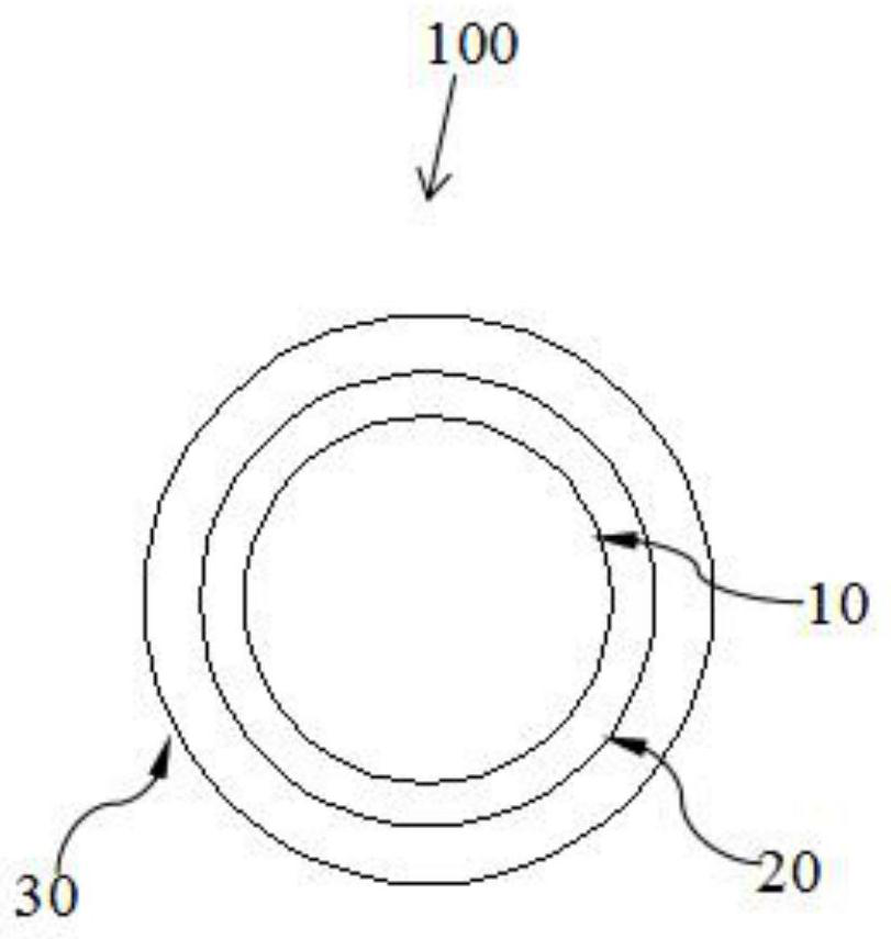 A y-shaped carotid stent with absorbable branches from the skeletal membrane