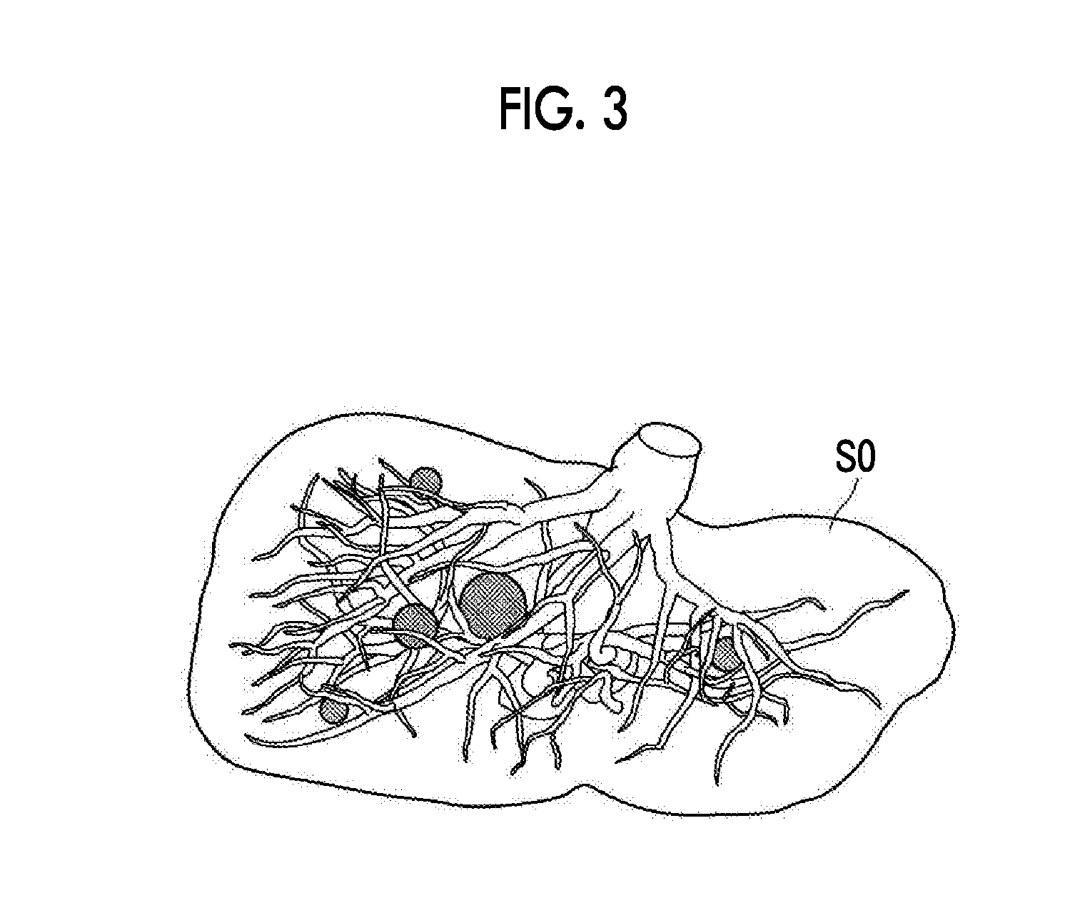 Image alignment device, method, and program