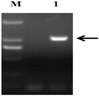 SMV (soybean mosaic virus)-resistant gene GmST1, cultivation method of GmST1 transgenic soybeans and application