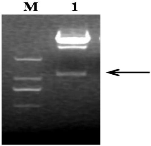 SMV (soybean mosaic virus)-resistant gene GmST1, cultivation method of GmST1 transgenic soybeans and application