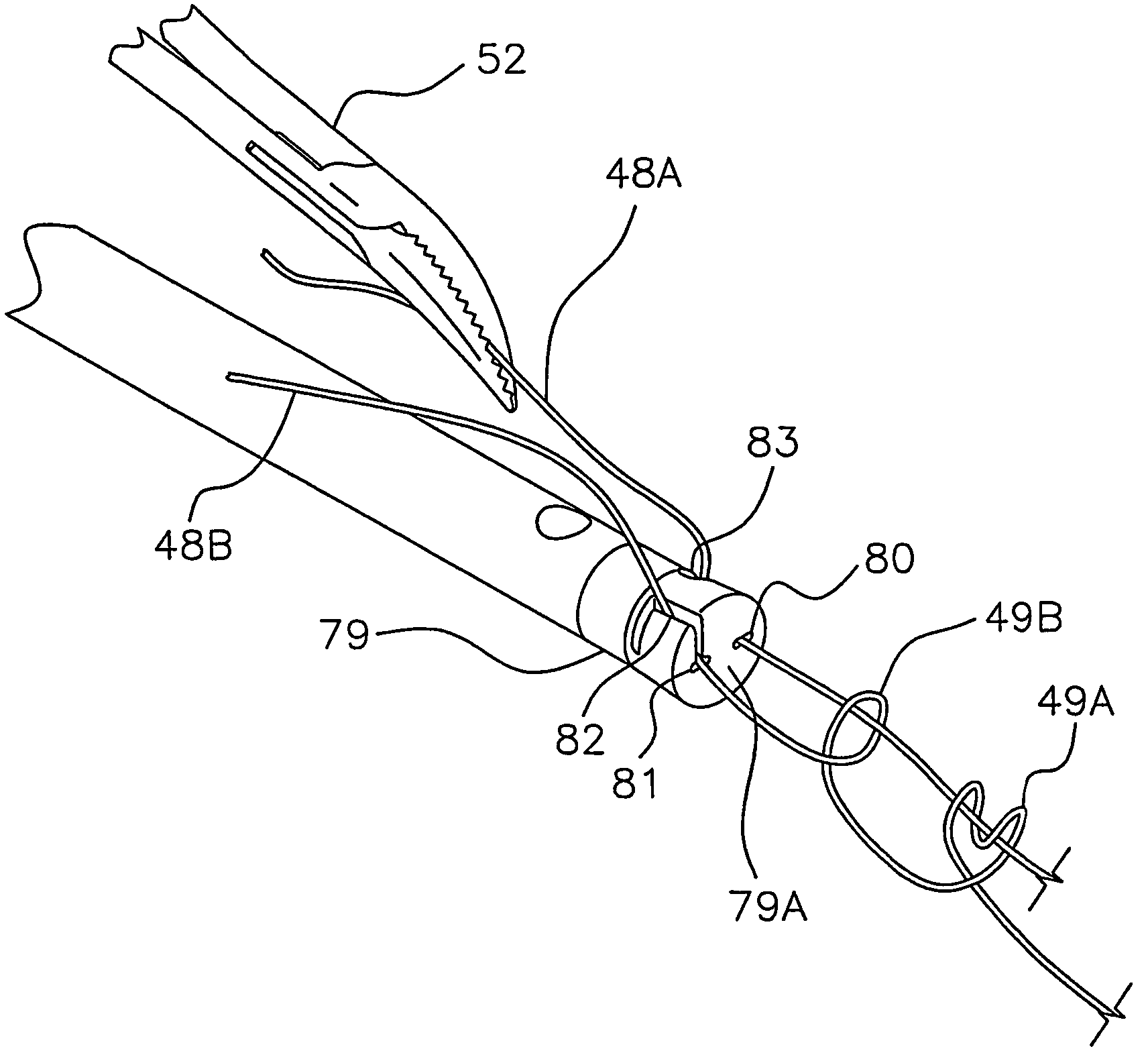 Instrument for assisting in the remote placement of tied surgical knots and trimming of suture away from the knot and method of use