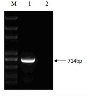 Duck virus hepatitis suicide DNA vaccine, as well as constructing method and application thereof