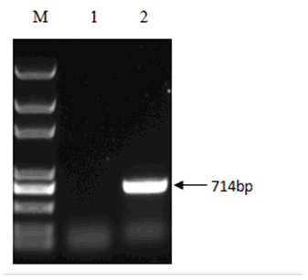 Duck virus hepatitis suicide DNA vaccine, as well as constructing method and application thereof