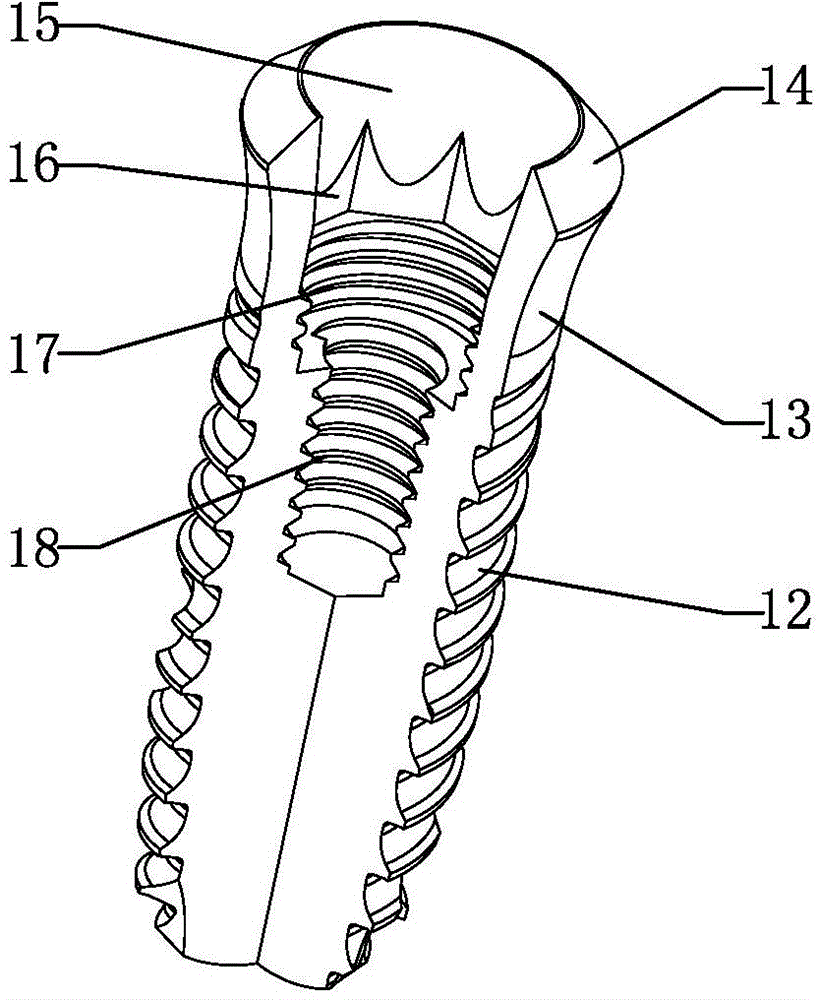 Easily-removing implant device and screwing-out tool thereof