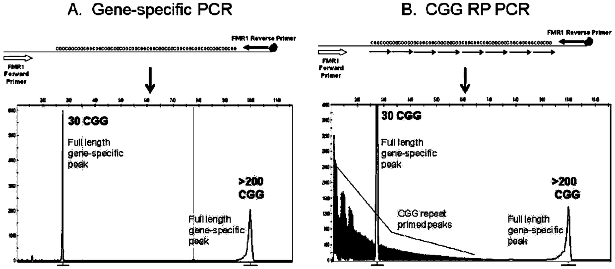 Fragile X syndrome FMR1 gene detection primer, kit and detection method