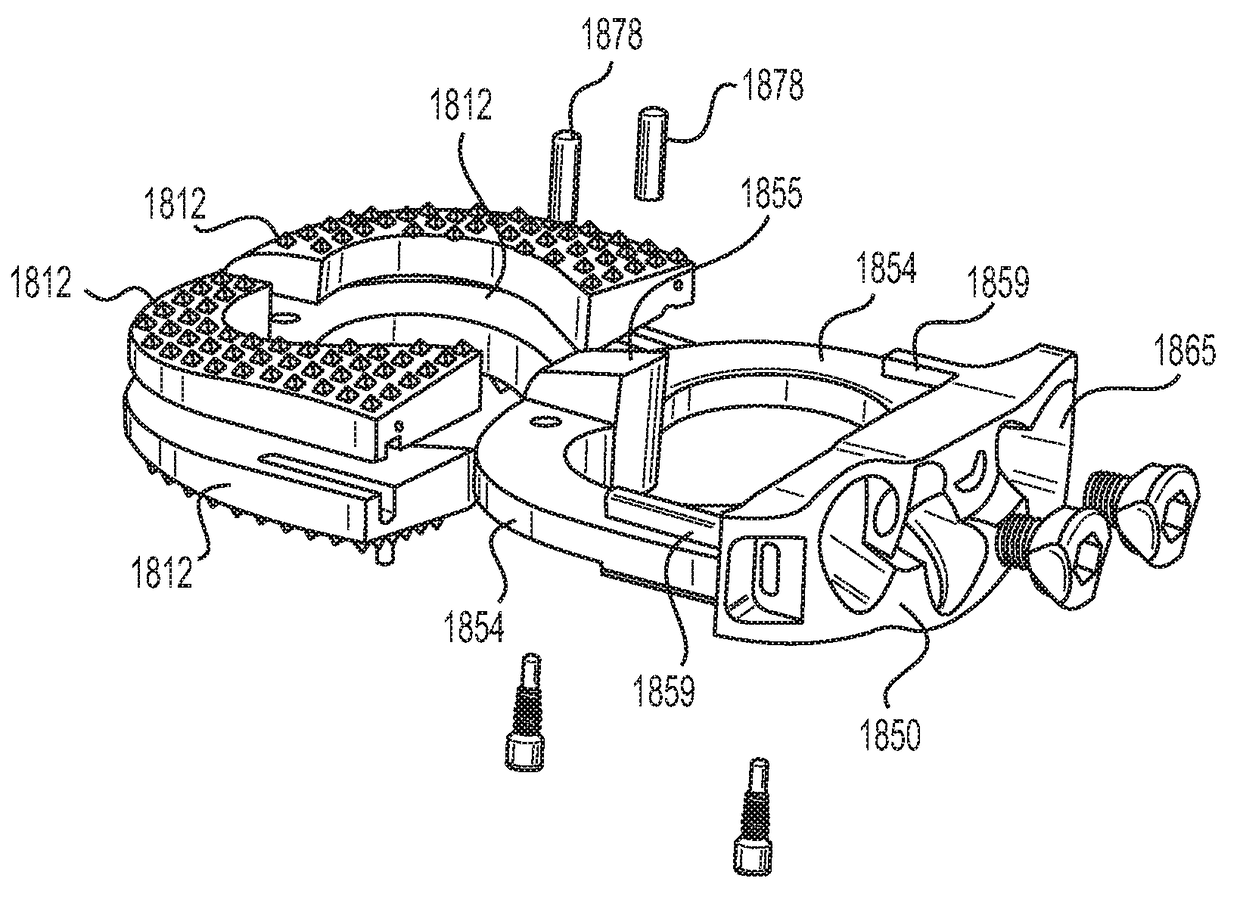 Standalone interbody implants