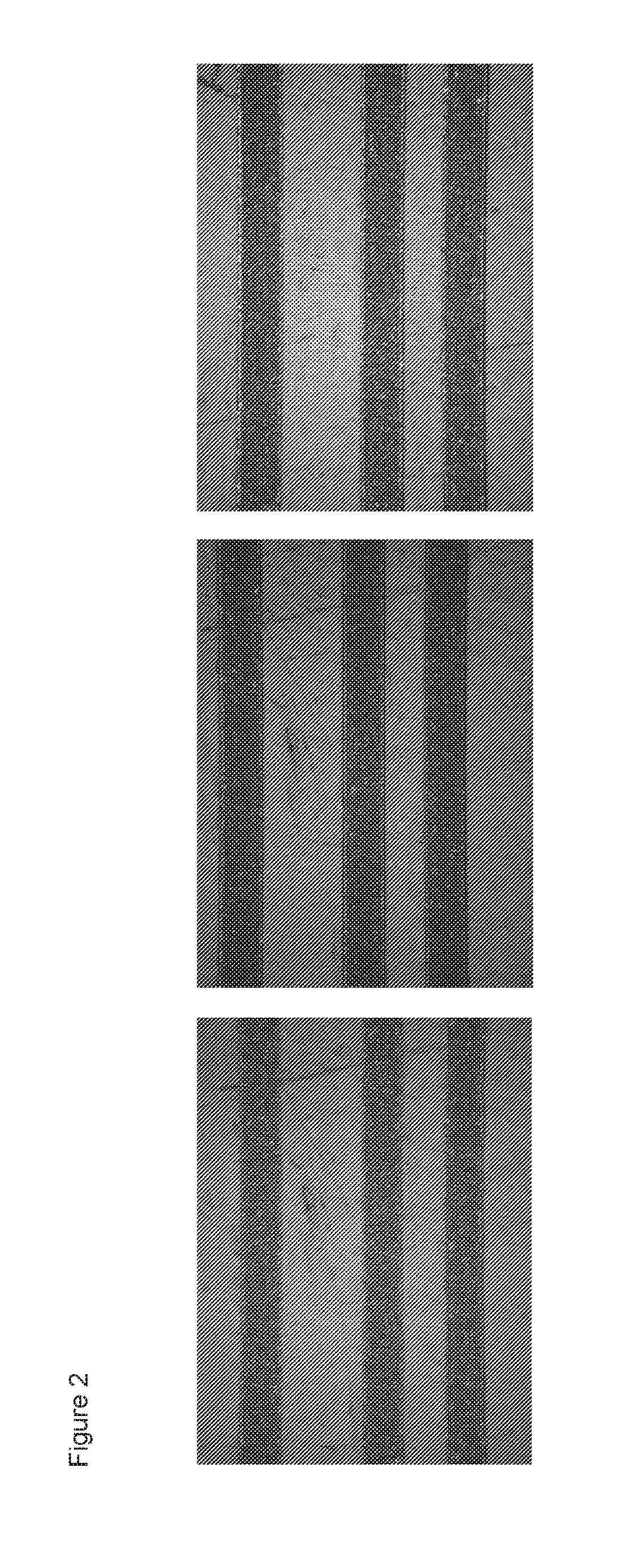 Stretchable Interconnects for Flexible Electronic Surfaces