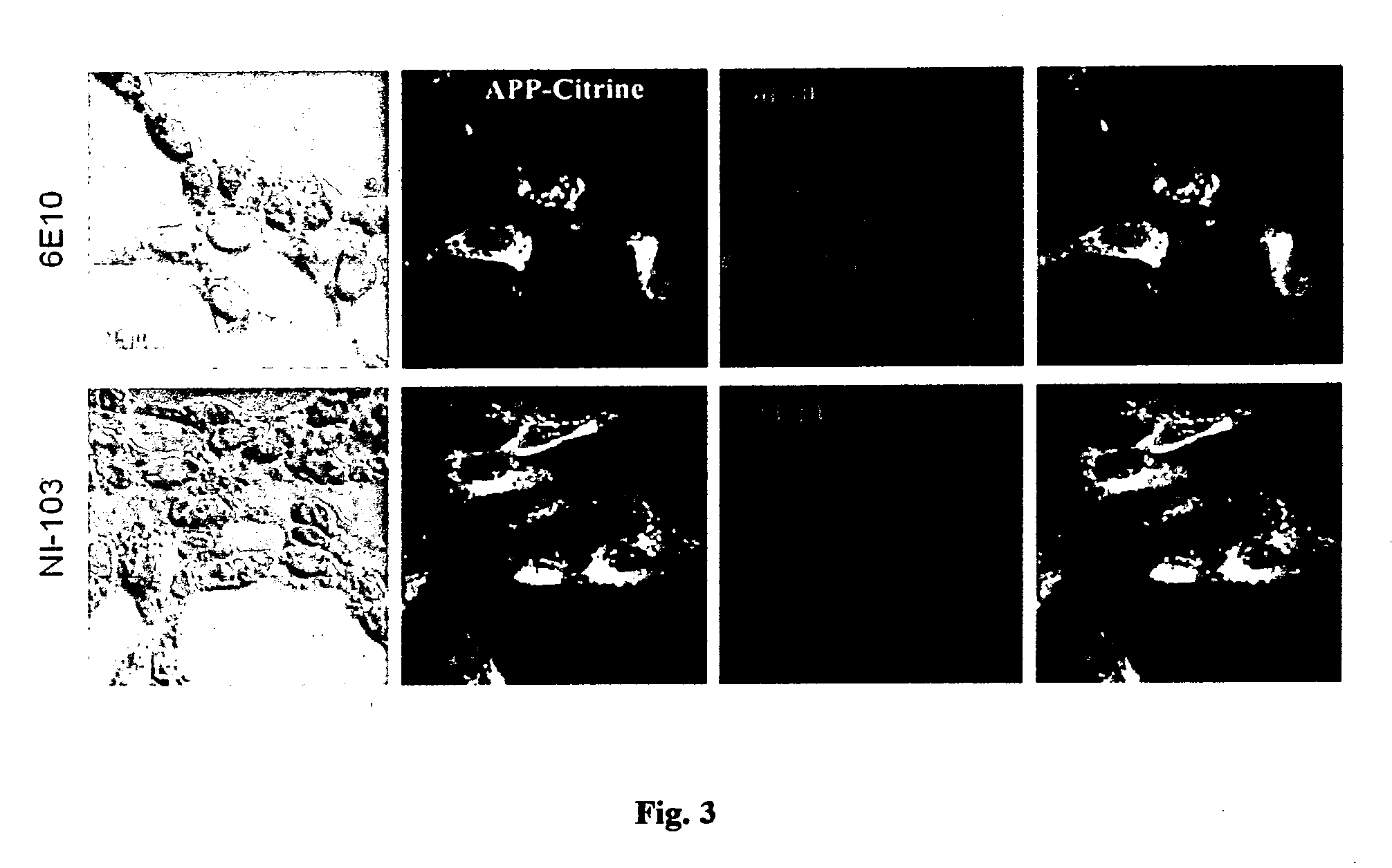 Moncolonal amyloid beta (ABETA) - specific antibody and uses thereof