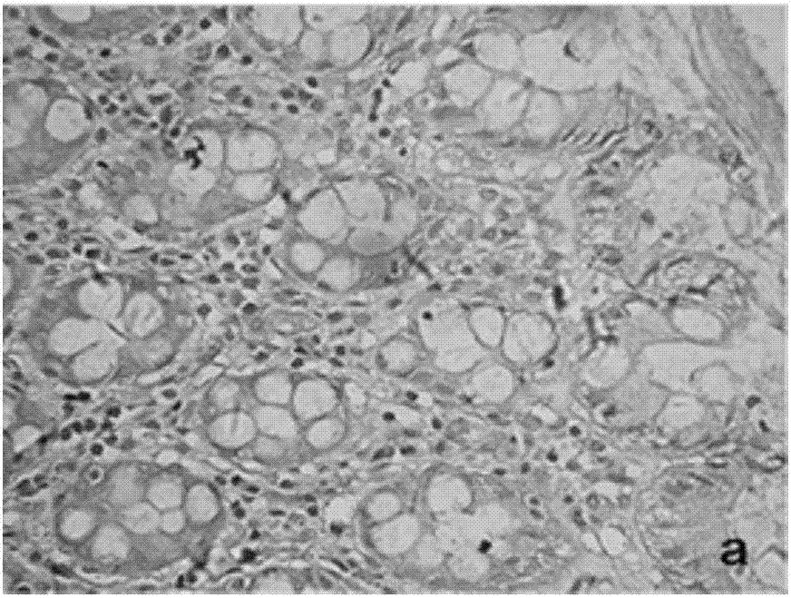 Application of KPNA2 (karyopherin alpha 2) gene and application of siRNA (small interfering ribonucleic acid) for inhibiting expression of KPNA2 gene