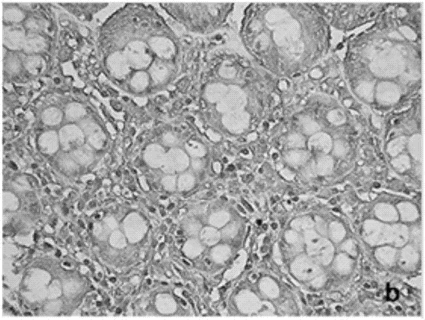 Application of KPNA2 (karyopherin alpha 2) gene and application of siRNA (small interfering ribonucleic acid) for inhibiting expression of KPNA2 gene