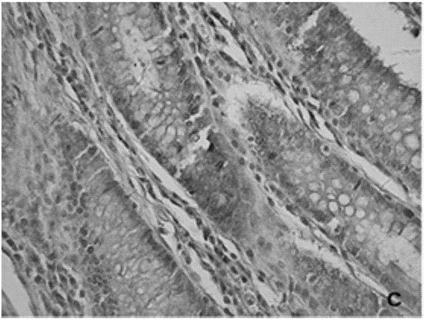 Application of KPNA2 (karyopherin alpha 2) gene and application of siRNA (small interfering ribonucleic acid) for inhibiting expression of KPNA2 gene