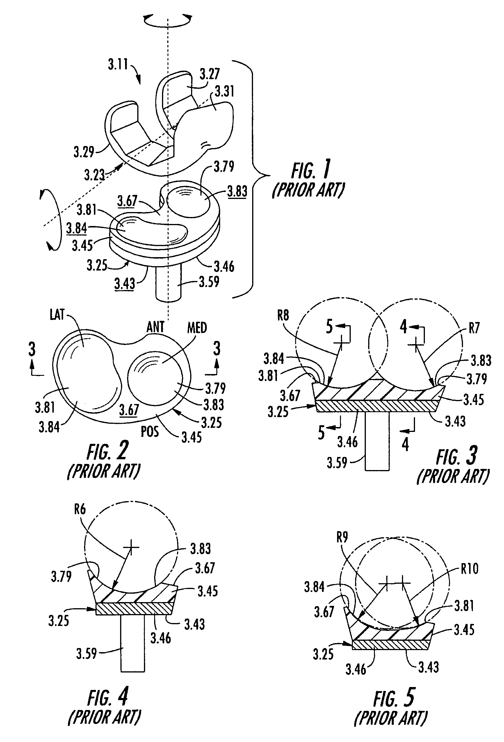 Tibial knee prosthesis