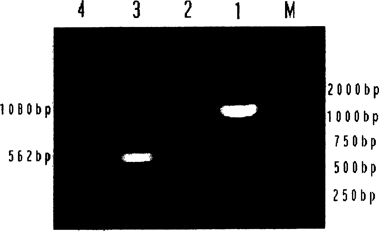 Mandarin fish infectious splenorenal necrosis virogene diagnostic kit and detecting method thereof