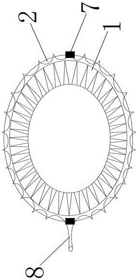 Fully fitting esophageal stent complying with esophageal peristalsis