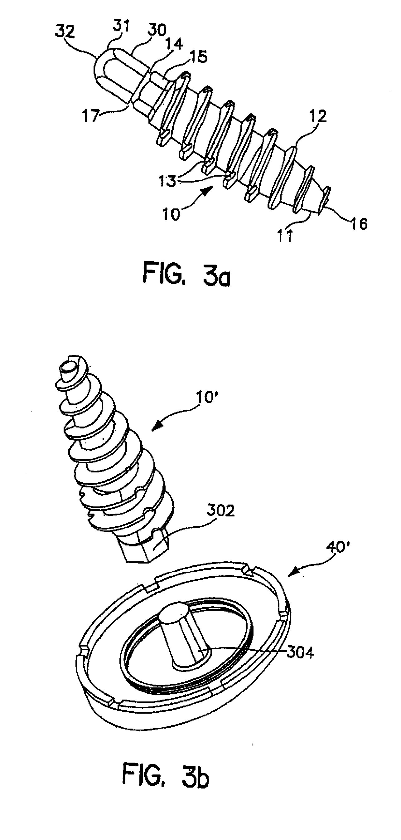 System and method for joint resurface repair