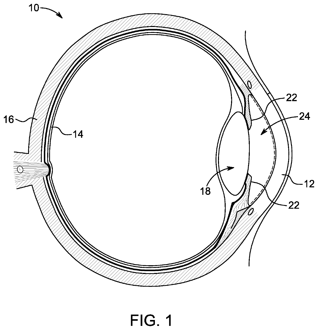 Artificial vision intraocular implant device