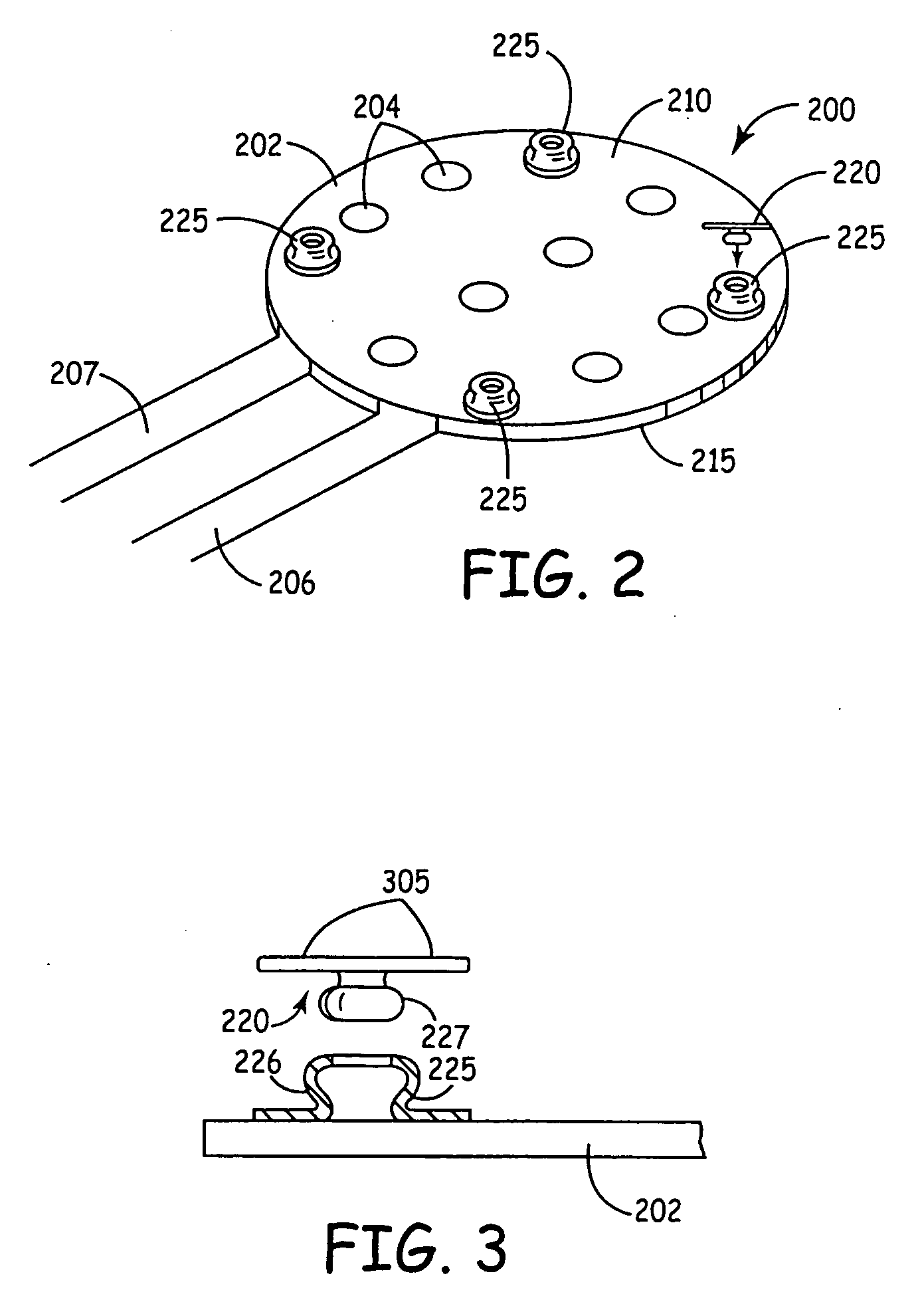 Anchoring of a medical device component adjacent a dura of the brain or spinal cord